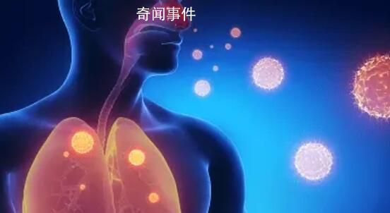 多国出现偏肺病毒感染 尚无治疗药物