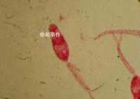 疾控提醒血吸虫接触10秒即可感染 警惕江水中的隐形杀手