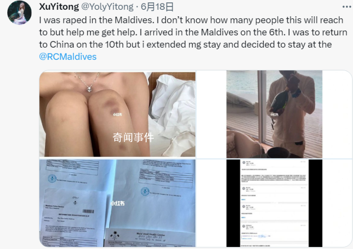 自曝遭性侵中国女生反驳酒店声明 目前案件正在调查中