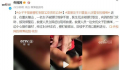 女子手指被铆钉刺穿120求助119 经过5分钟拔出后续手术得以顺利进行