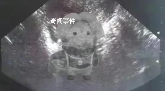 蔡徐坤被曝还有另一位秘密情人 将公布亲密照片和视频 
