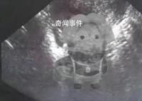 蔡徐坤被曝还有另一位秘密情人 将公布亲密照片和视频 