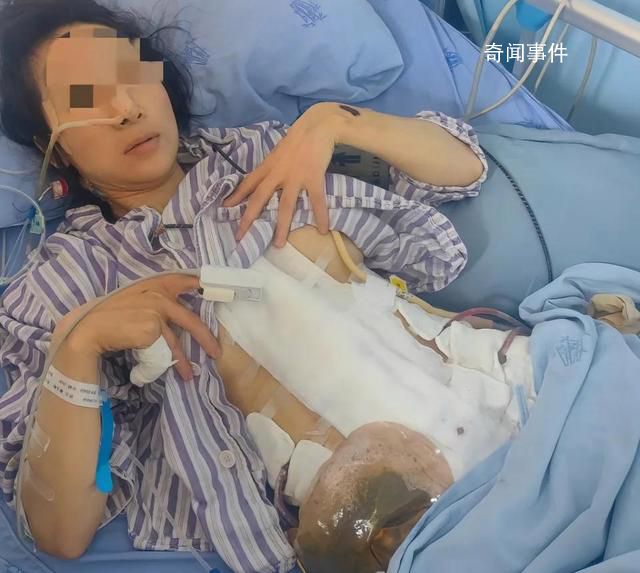 妇联回应女子2年被老公家暴16次 已介入调查