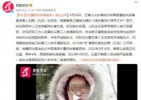 女医生遭前夫投毒案多人被处分 前夫获刑八年半
