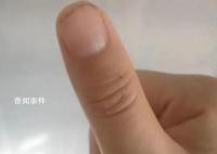 荔枝季致广东人拇指成黑色 今年荔枝最佳赏味期还有7-10天