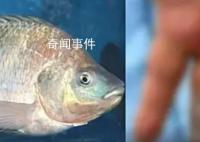 男子被鱼刺刺伤致手指坏死被切除