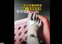 女孩被蛇咬伤奶奶抓蜘蛛吸毒 不仅没有好转反而口腔出血严重
