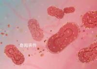 多地多人确诊 如何避免感染猴痘病毒
