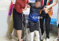 9岁马蹄足男孩术后站起来了 满斯棋是一位先天性马蹄足患者