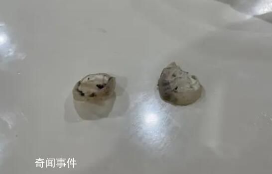 异物是鸭眼巩膜?记者解剖多个鸭头