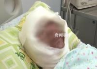 老人进厨房没多久煤气发生爆炸 老人已送医