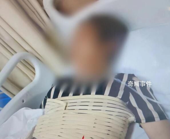 奶奶疑骂孙子被误会遭围殴骨折 造成3根肋骨骨折