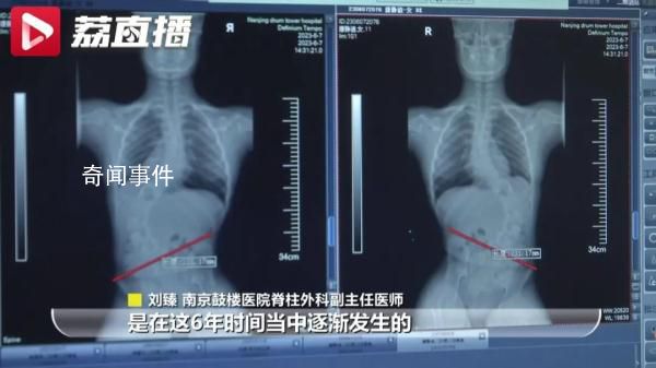 仅3周接诊5名下腰瘫痪孩子 背后真相令人震惊