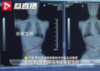 仅3周接诊5名下腰瘫痪孩子 背后真相令人震惊