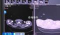 36岁男子吹空调住进ICU 如何预防空调病