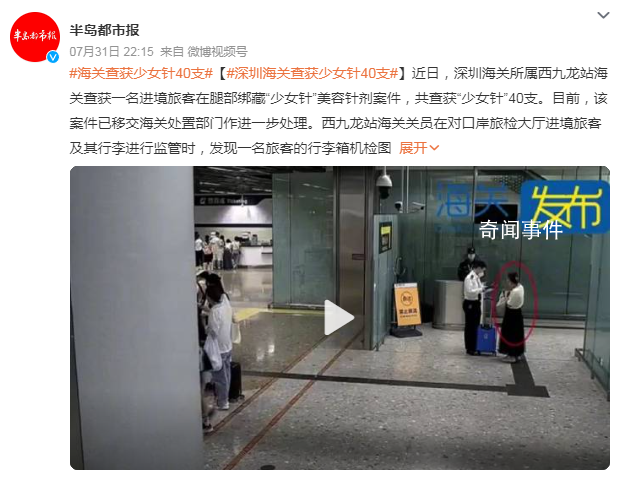 女子过海关双腿绑满少女针 已移交海关处置部门作进一步处理