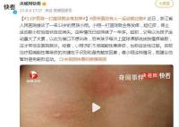 13岁男孩一打篮球就全身发痒 这种情况已经持续了一年多