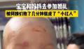 宝宝参加婚礼被亲一脸口红印 成为了小红人