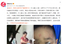 母亲为保护孩子遭到殴打 正全方位取证