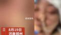 女子没给丈夫钱充手游被殴打失明 目前警方已经介入调查
