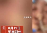 女子没给丈夫钱充手游被殴打失明 目前警方已经介入调查