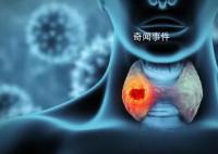 浙江12岁女孩确诊甲状腺癌 小小年纪为什么会扯上甲状腺癌