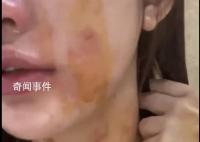 23岁女子自曝遭夫妻两人殴打扒衣 当事双方按照流程做伤情鉴定