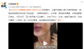 女子遭夫妻扒衣掐脖?警方介入