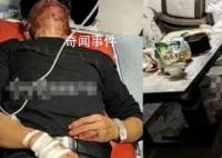 公职人员上门打71岁老人 双方已和解