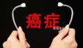50岁以下人群癌症新发病例数激增 比1990年增长了79%
