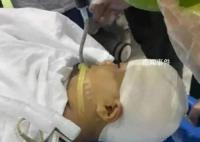 小学生被男教师打碎头骨?警方介入