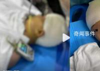 打破学生头骨老师停职接受公安调查 受伤学生已及时送医治疗