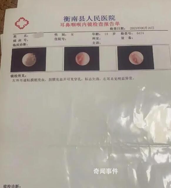 学生被老师掌掴耳膜穿孔?学校回应