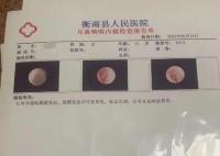学生被老师掌掴耳膜穿孔?学校回应