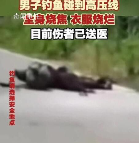 男子钓鱼误碰高压线 全身焦黑