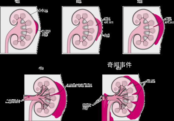 女生经期用按摩仪按腰致肾破裂 这些情况切记不要乱按摩