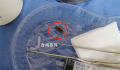 男子半夜卧床玩手机蟑螂钻进耳朵 传来一阵剧烈的疼痛