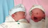 59岁生双胞胎女儿 产妇回应质疑