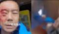 游客遭穿制服人员殴打 其妻发声
