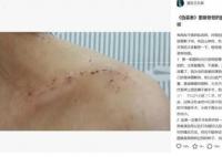 胡歌被曝拍伪装者时砸断女主锁骨 并怒怼胡歌粉丝