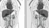 女子就医发现五脏六腑全长反 什么是镜面人