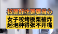 女子吃烤栗子被炸嘴肿得张不开 商家顾客都有点虎