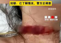 女子称孕期遭家暴被丈夫拿刀割脖子 目前警方正在调查处理
