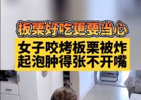 女子吃烤栗子被炸嘴肿得张不开 商家顾客都有点虎
