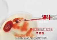 男子误喝防冻液血液呈胶冻状离世 治疗无效不幸去世
