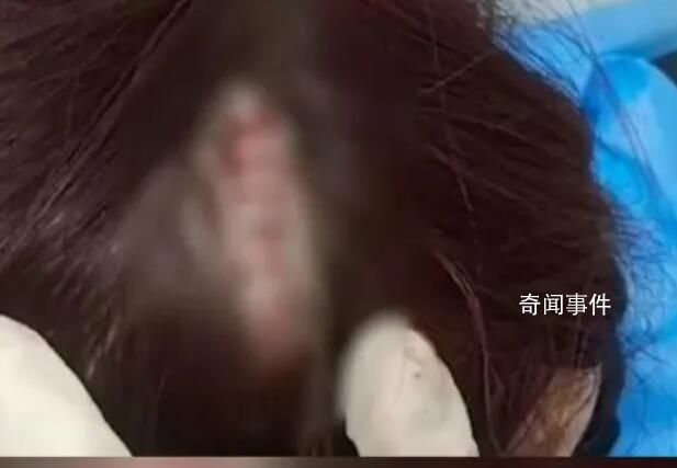 女子在景区提醒禁练铁头功处撞破头