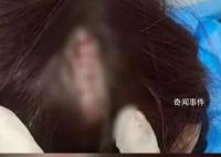 女子在景区提醒禁练铁头功处撞破头