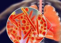 肺炎支原体感染迎来高峰?医生回应
