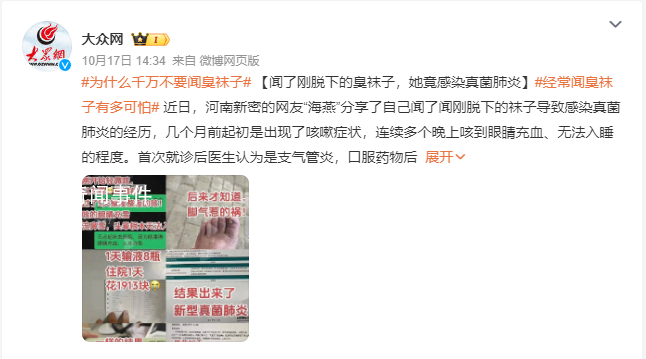 女子闻刚脱下的袜子感染真菌肺炎 几个月前起初是出现了咳嗽症状
