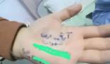 巴勒斯坦官员:孩子把名字写在掌心